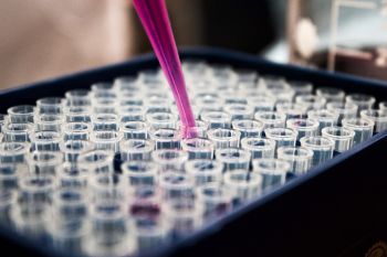 Biochemistry lab worker filling vials for testing