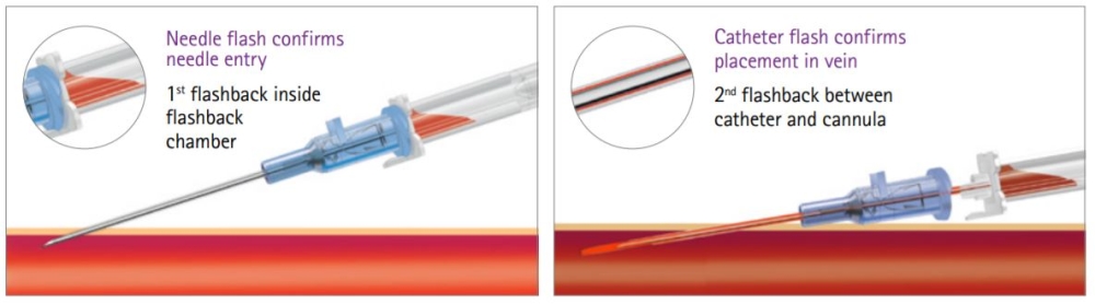 Iv Catheter Ecocann 26 G Iv Cannula Catheter With Luer Lock