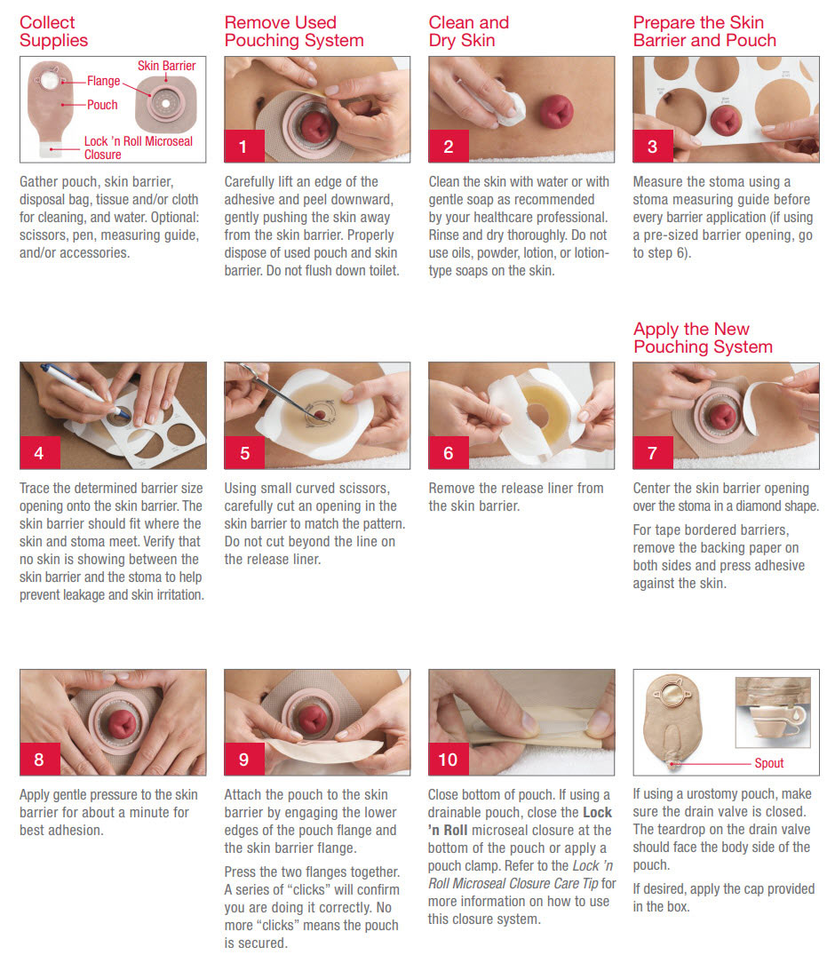 Two-Piece Pouching Systems, Ostomy Care Products