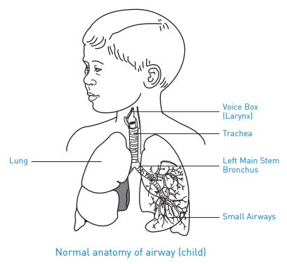 Smiths Medical 67SP040 - TUBE TRACHEOSTOMY PEDIATRIC SIZE 4MM