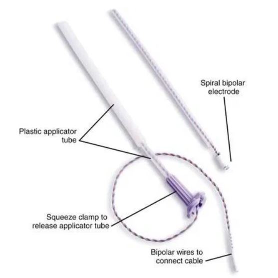 GE Healthcare 7000AAO ELECTRODE, FETAL SCALP, QWIK CONNECT, 50/CS CIA Medical