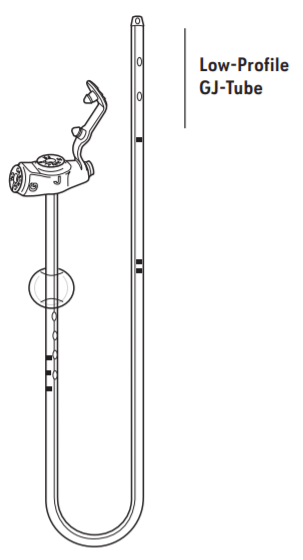 Avanos MIC-KEY Gastric-Jejunal Feeding Tube Endoscopic/Radiologic Placement