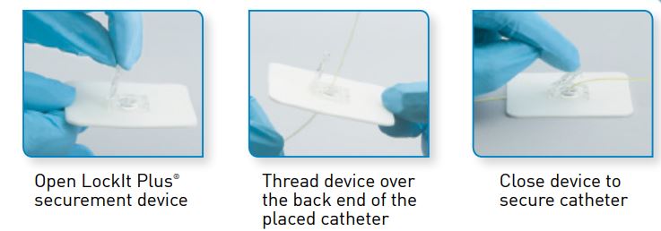 LOCKIT Plus Epidural Catheter