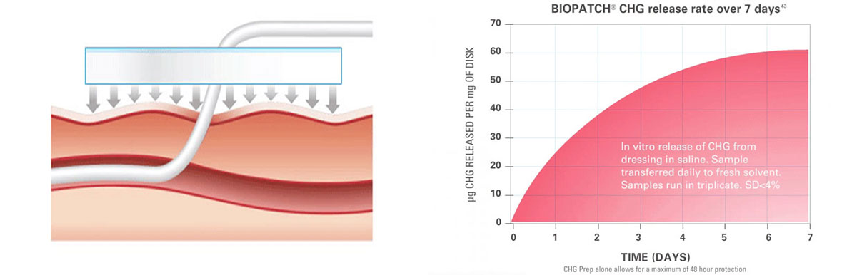 Ethicon 4150 BIOPATCH Protective Disk with CHG