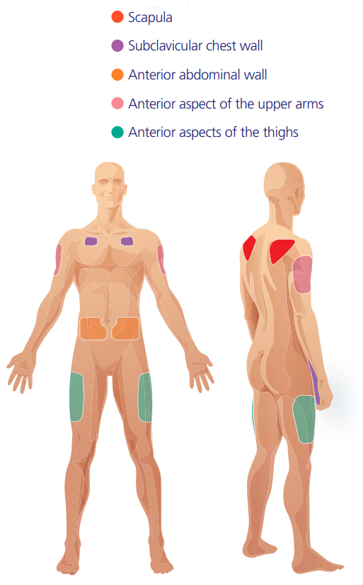 BD_Subcutaneous_Infusion_Therapy