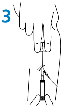 BD Saf-T-Intima closed IV catheter Insertion Guide