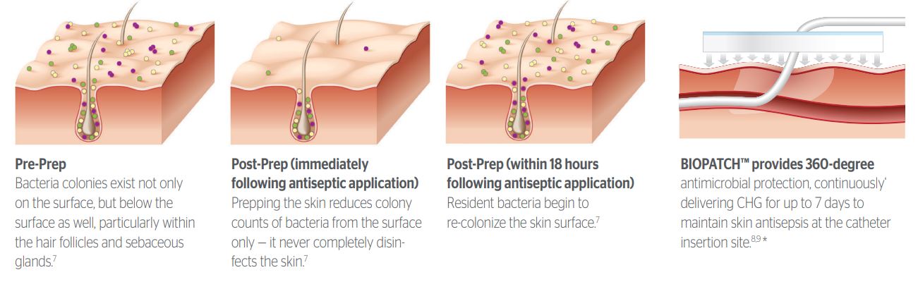 BIOPATCH Protective Disk with CHG