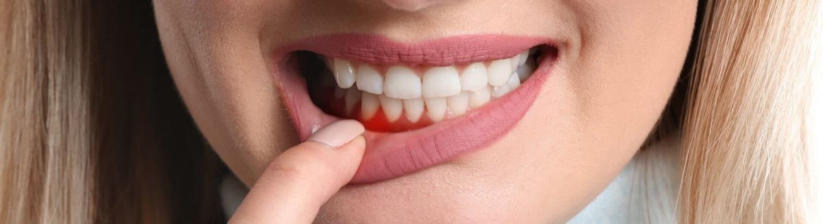 Periodoncia