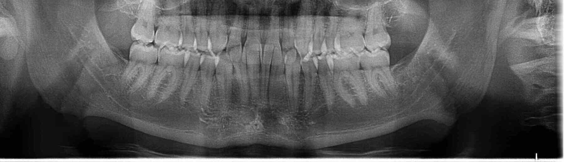 Cirugía maxilofacial