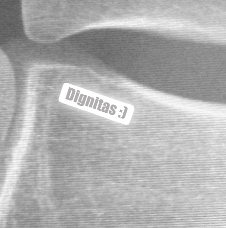Wrist X-ray showing 'Dignitas :)' message (detail)