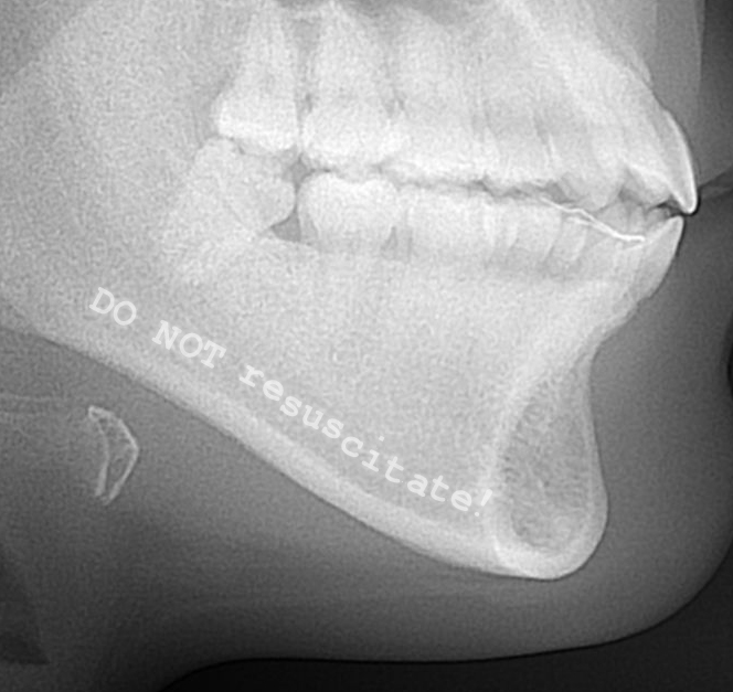 Skull X-ray showing ‘Do not resuscitate’ message (detail)