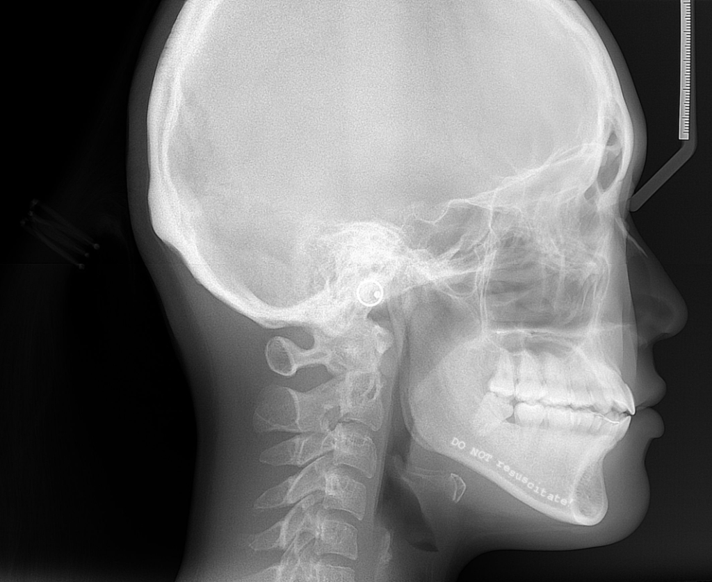 Skull X-ray showing 'Do not resuscitate' message