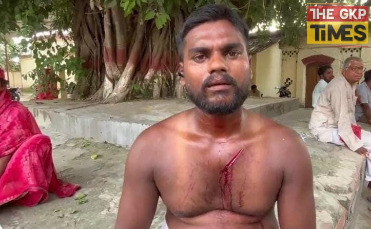 हिसाब मांगने पर ट्रैक्टर ड्राइवर को बंधक बनाकर जानलेवा हमला