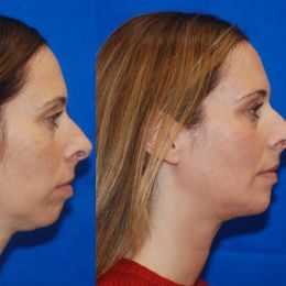 Mary Lynn Moran, MD photo 2 of 4