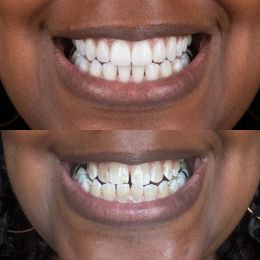 Potomac Dental and Implant Center photo 1 of 4