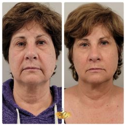 Augusta Anti-Aging Medicine photo 3 of 6