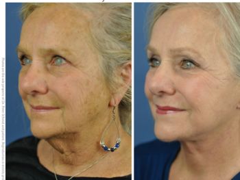 Institute of Aesthetic Plastic & Reconstructive Surgery