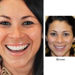 Cosmetic Dentistry by Dr. Ned Shimizu