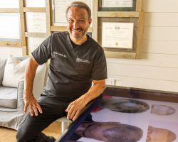 North Atlanta Hair Restoration