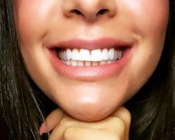 Brighter Smiles of Davidson