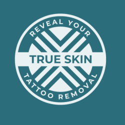 True Skin Tattoo Removal
