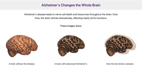 Changes of the brain