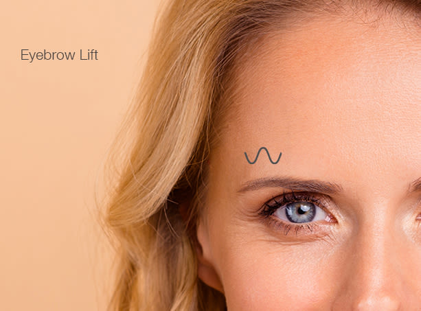 eyebrow-lift