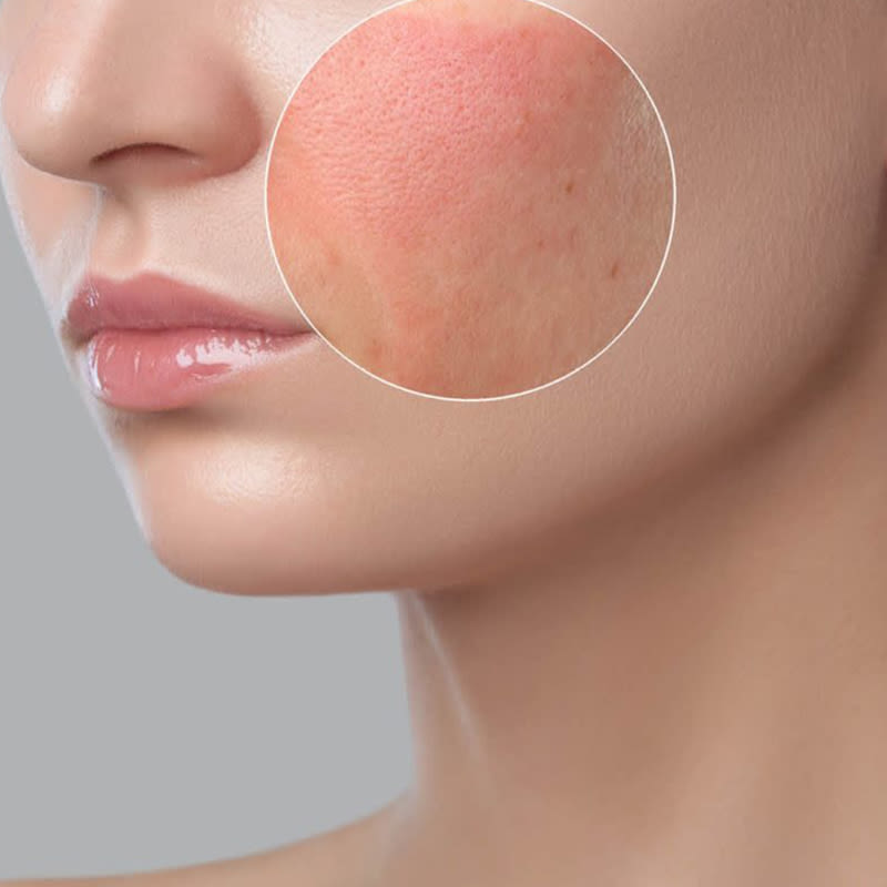 clear skin clinics miranda