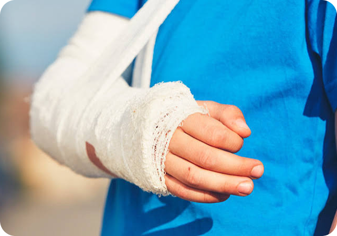Arm in a cast and sling