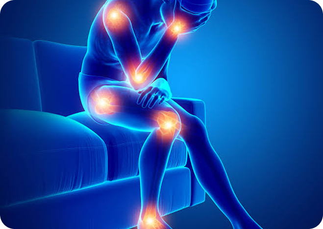 Illustration of joint pain points