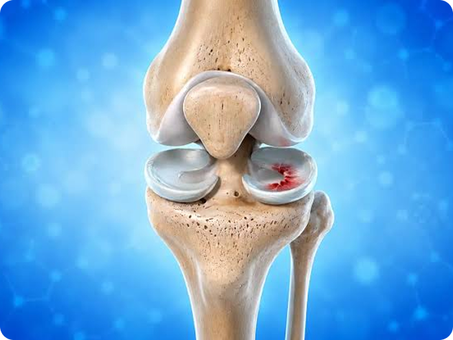 Illustration of the knee joint
