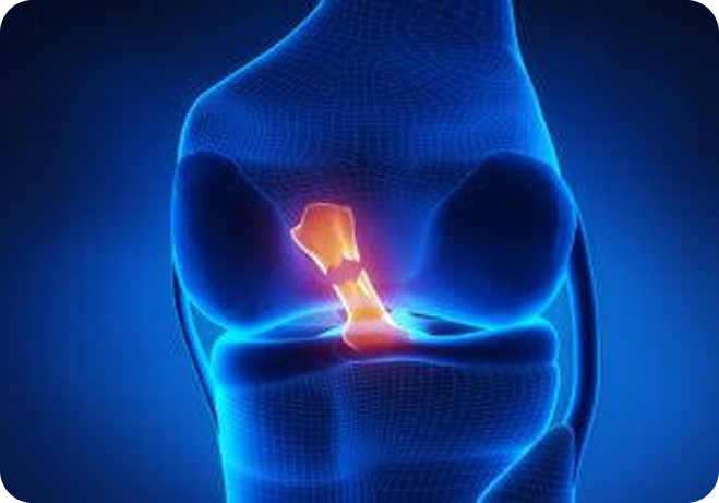 Person at the gym holding a painful knee