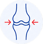 Osteoarthritis