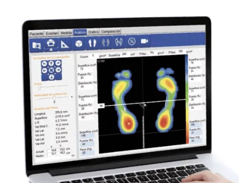 Estudio de la Pisada y Plantillas