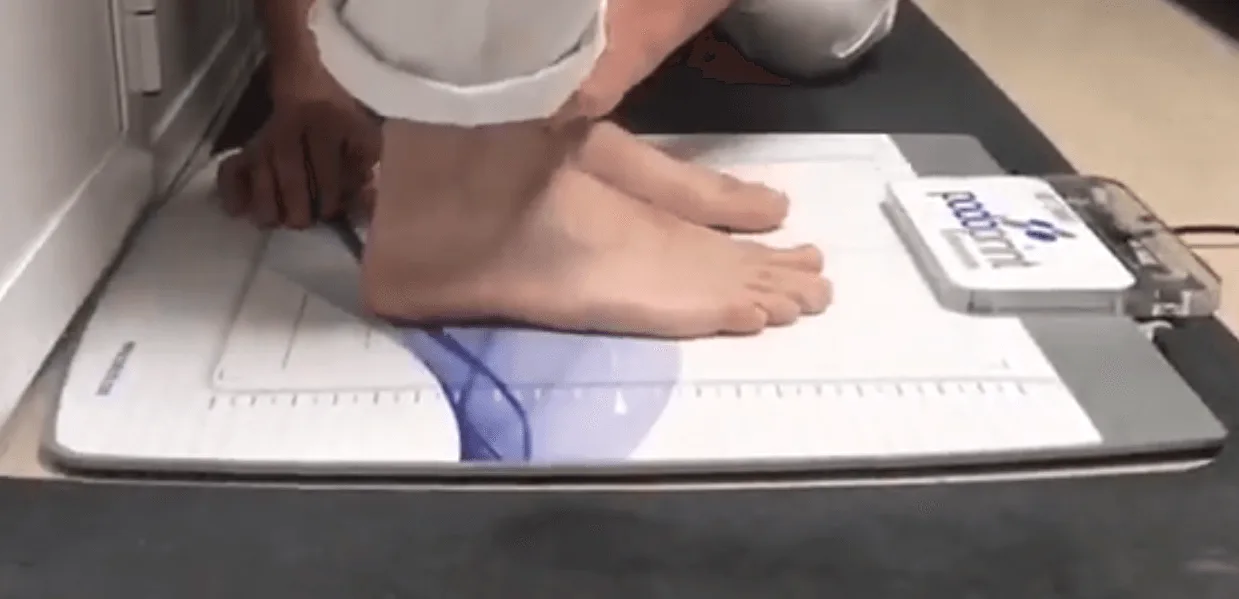 Estudio de la Pisada y Plantillas