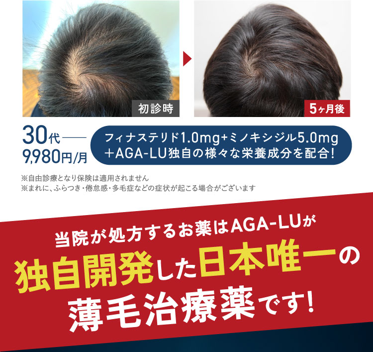 党員が処方するお薬はAGA-LUが独自開発した日本唯一の薄毛治療薬です！