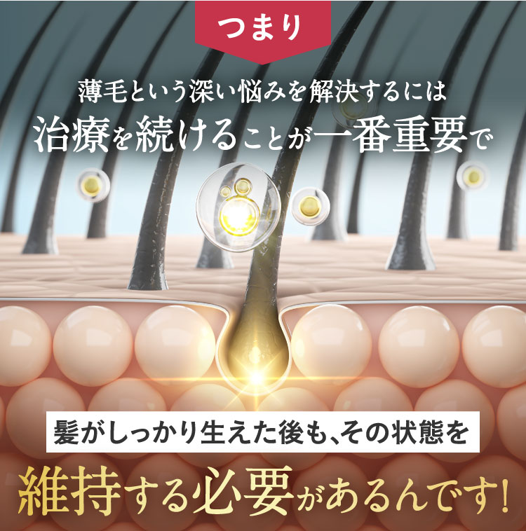 つまり、薄毛という深い悩みを解決するには治療を続けることが一番重要で髪がしっかり生えた後も、その状態を維持する必要がある！