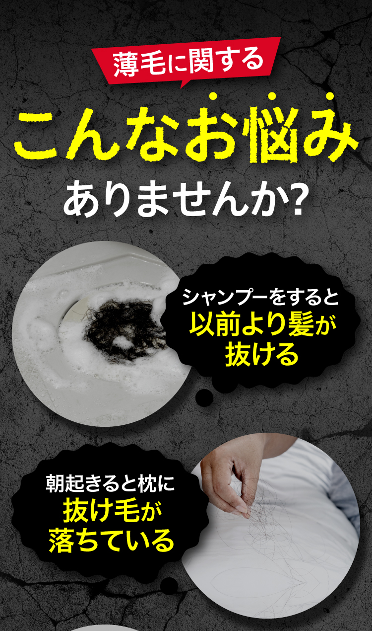 薄毛に関するこんなお悩みありませんか？