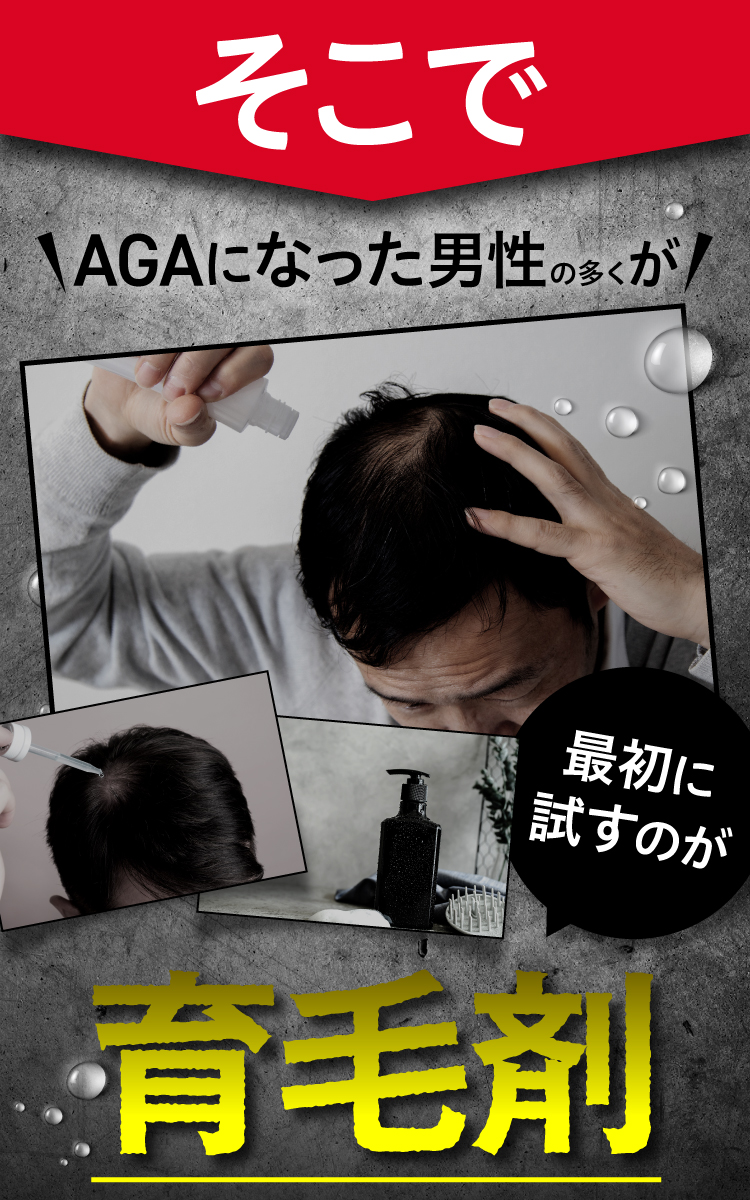 最初に試すのが育毛剤