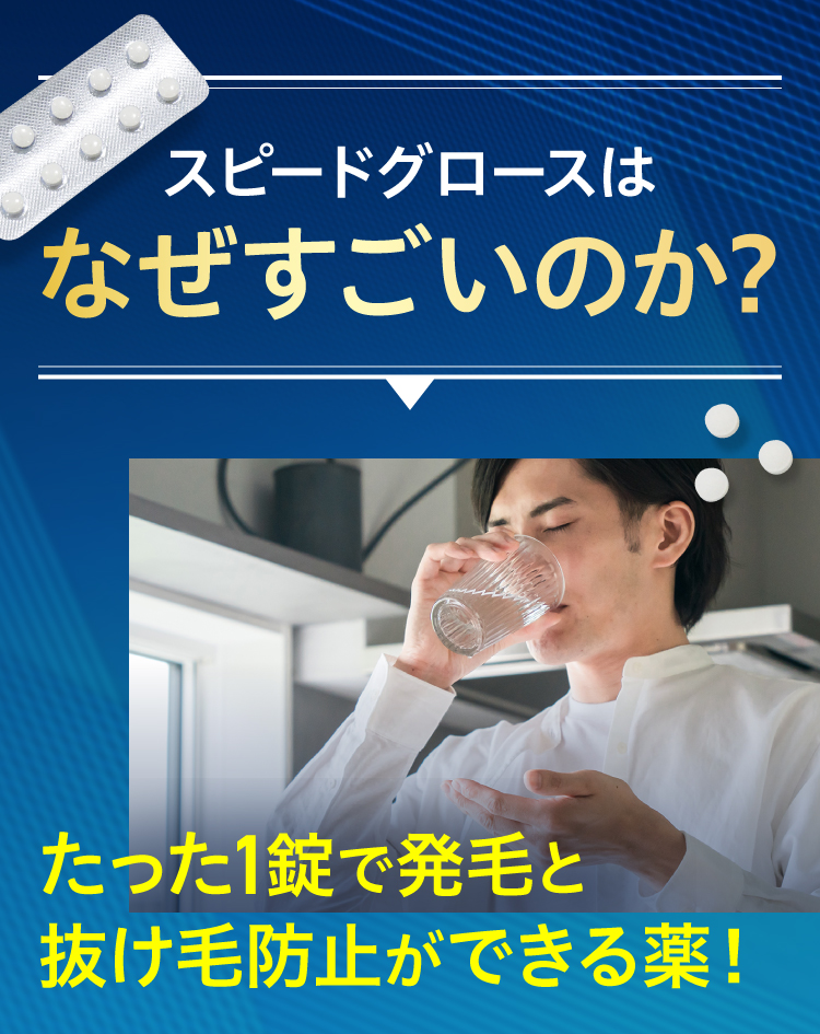 スピードグロースはなぜすごいのか？日本初＆唯一！！たった1錠で発毛と抜け毛防止ができる薬！