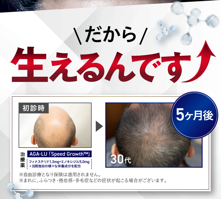 そんなスピードグロースはなんと…発毛実感率が99％だから生えるんです