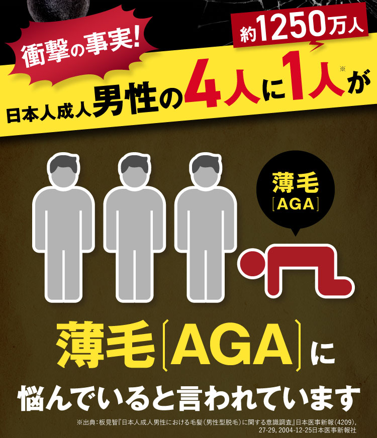 衝撃の事実！日本人成人男性の4人に1人が薄毛に悩んでいると言われています