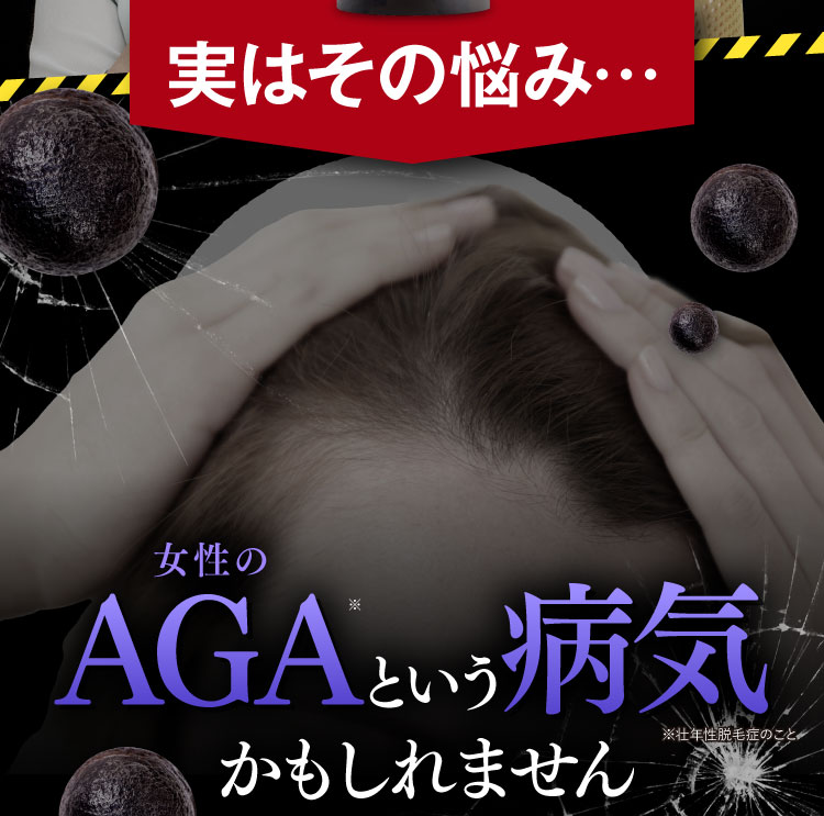 実はその悩み…FAGAという病気かもれません