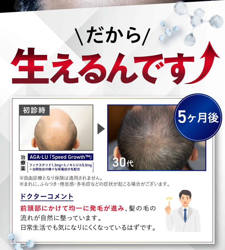 そんなスピードグロースはなんと…発毛実感率が99％だから生えるんです