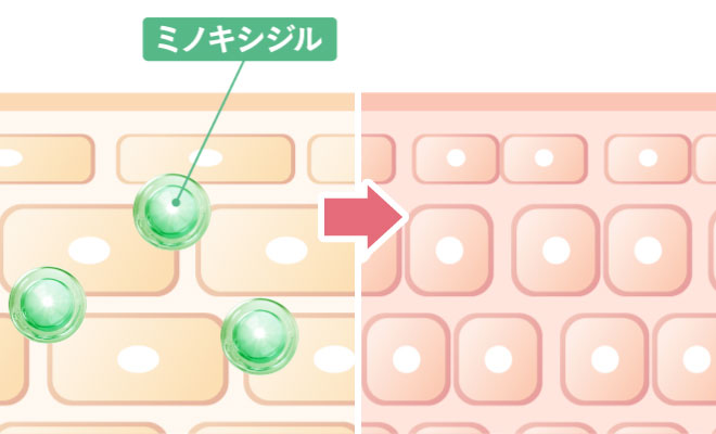 ミノキのイラスト