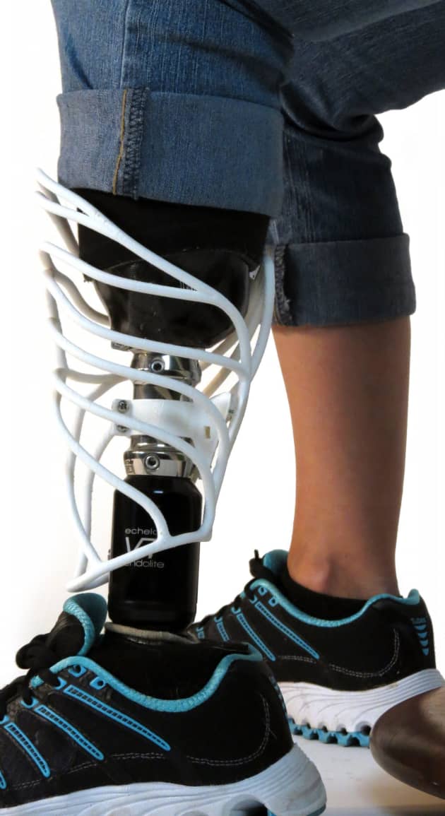 Prosthetic Skins
