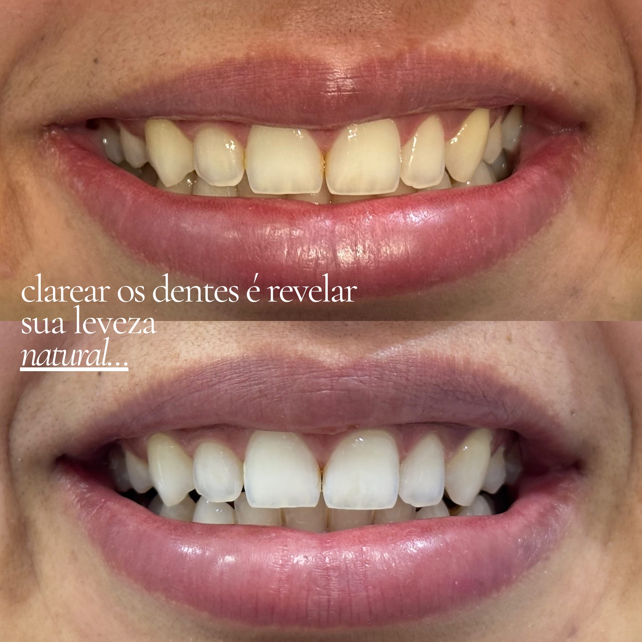 Foto 4 da galeria