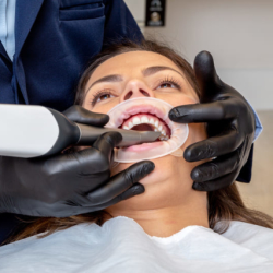 Foto de Scanner intraOral