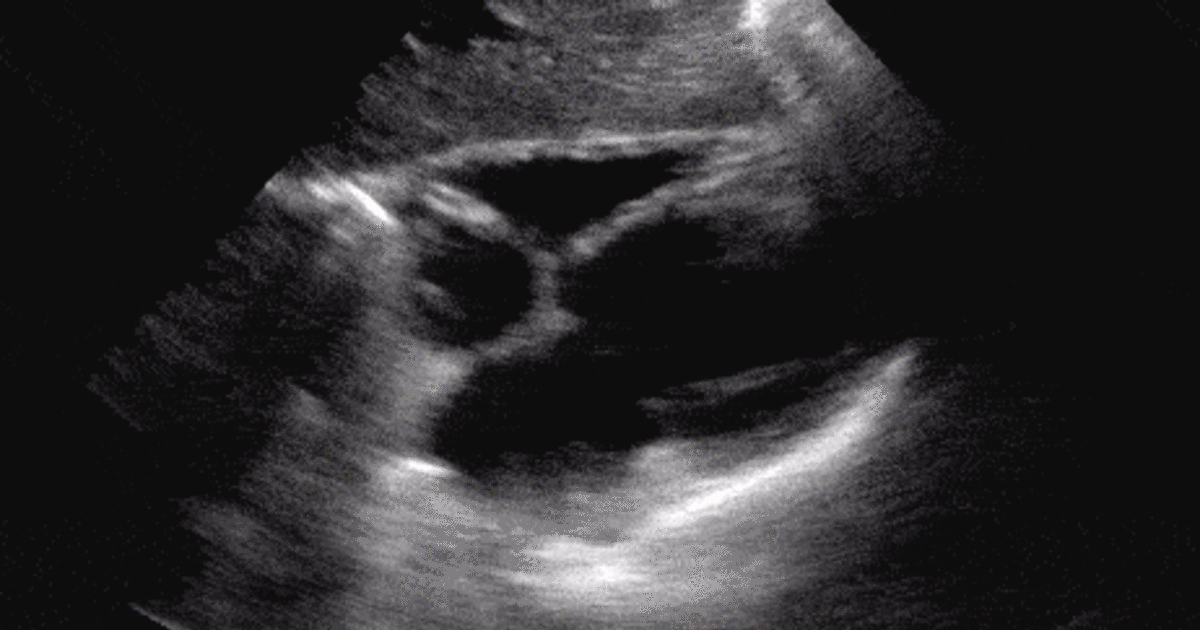 Ultrasound Quiz 1 Back to Basics