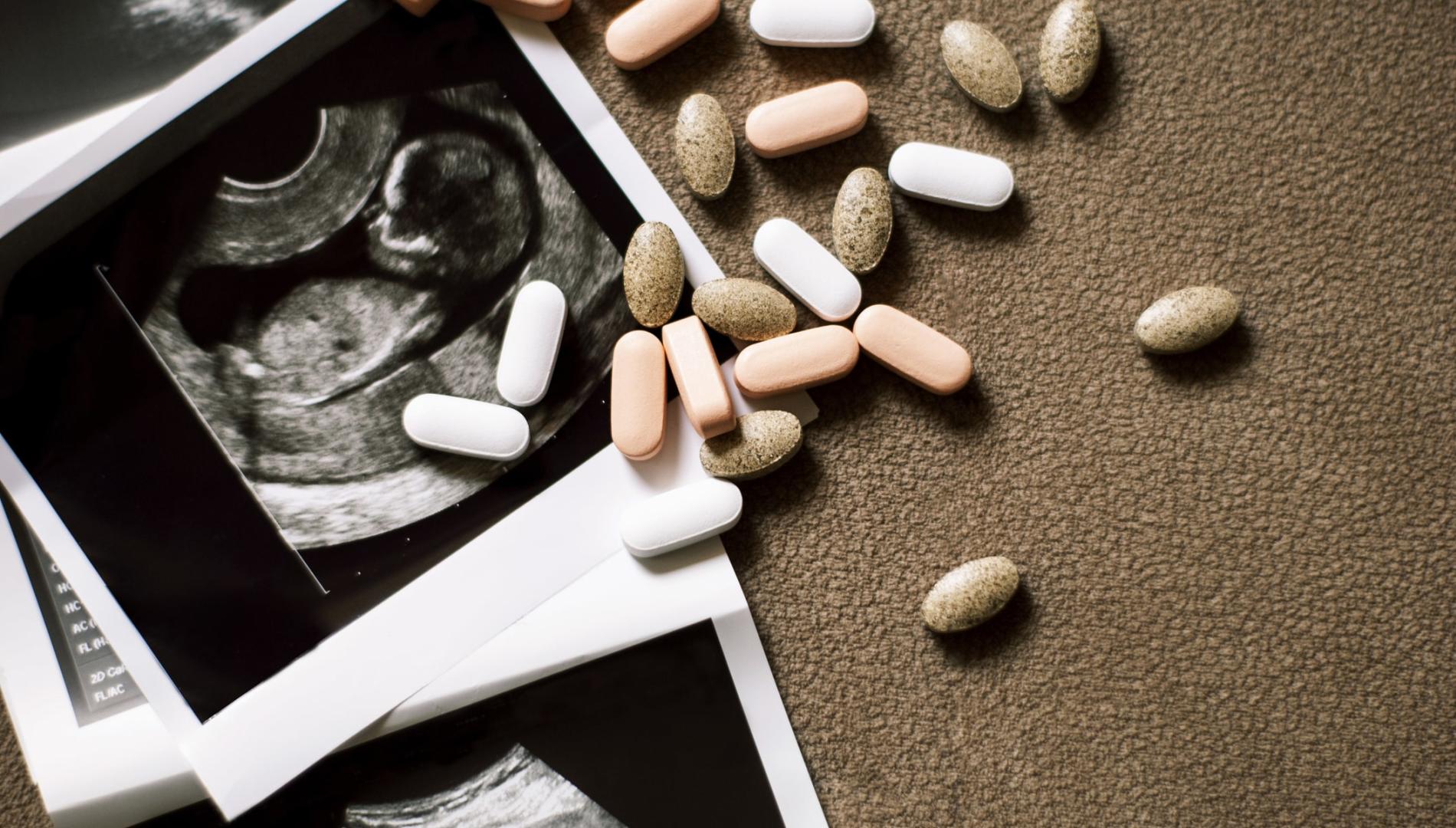 Ultrasound images of a foetus with scattered pills on brown background. 